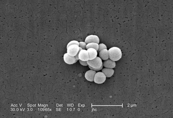 Micrococcus luteus, ampliado 10.000 veces, produce olor corporal. Foto Janice Haney Carr/CDC